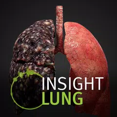 INSIGHT LUNG APK download