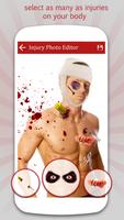 Injury Photo Editor تصوير الشاشة 2