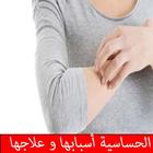الحساسية أسبابها و علاجها‎ icon