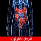 أمراض القولون icon