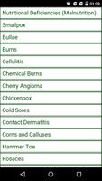 Poster Skin Disease And Treatment