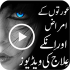 Aurton Kay Amraz Zeichen