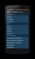 Atlas of MRI Brain Anatomy पोस्टर