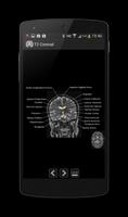 Atlas of MRI Brain Anatomy captura de pantalla 2