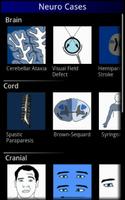 Neurology cases poster