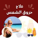 APK حروق الشمس ومعالجتها