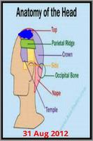 Migraine Pic ảnh chụp màn hình 1