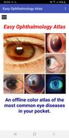 Easy Ophthalmology Atlas poster