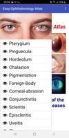 Easy Ophthalmology Atlas تصوير الشاشة 1