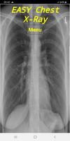 Easy Chest X-Ray poster