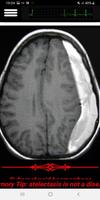 Easy Head CTScan screenshot 3