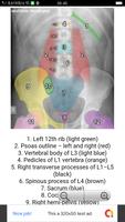 Abdominal X-Rays For Medical Students Cartaz