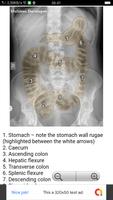 Abdominal X-Rays For Medical Students imagem de tela 1
