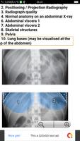 Abdominal X-Rays For Medical Students imagem de tela 3