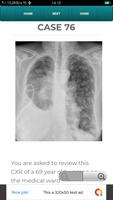 POCKET RADIOLOGIST CXR imagem de tela 2