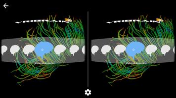 VRiBraiN ภาพหน้าจอ 2