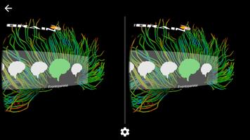 VRiBraiN ภาพหน้าจอ 3