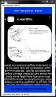 Snake Bite How to Safe Ekran Görüntüsü 2