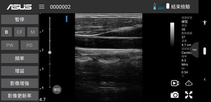 MediConnect – ASUS Ultrasound Screenshot 2