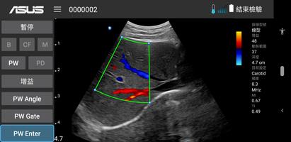 MediConnect – ASUS Ultrasound capture d'écran 3