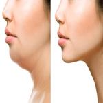 How To Lose Face Fat icon