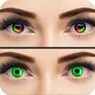 Augenfarbe Wechsler Veränderun