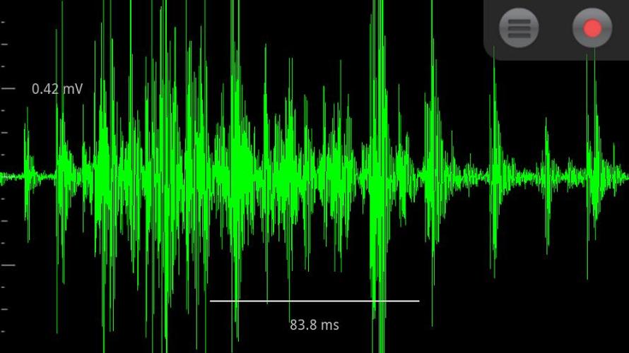 Download Spike Recorder latest 1.8.2.2 Android APK