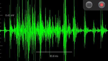 Spike Recorder โปสเตอร์