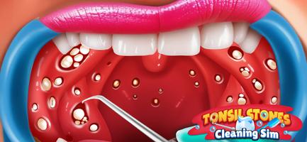 Tonsil Stones Simulator スクリーンショット 1