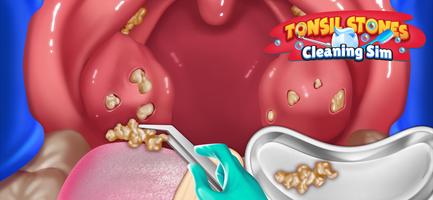 Tonsil Stones Simulator スクリーンショット 2