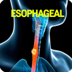 Esophageal Cancer