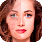 Blemish Remover - Face Editor icon