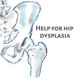 Help for Hip Dysplasia APK