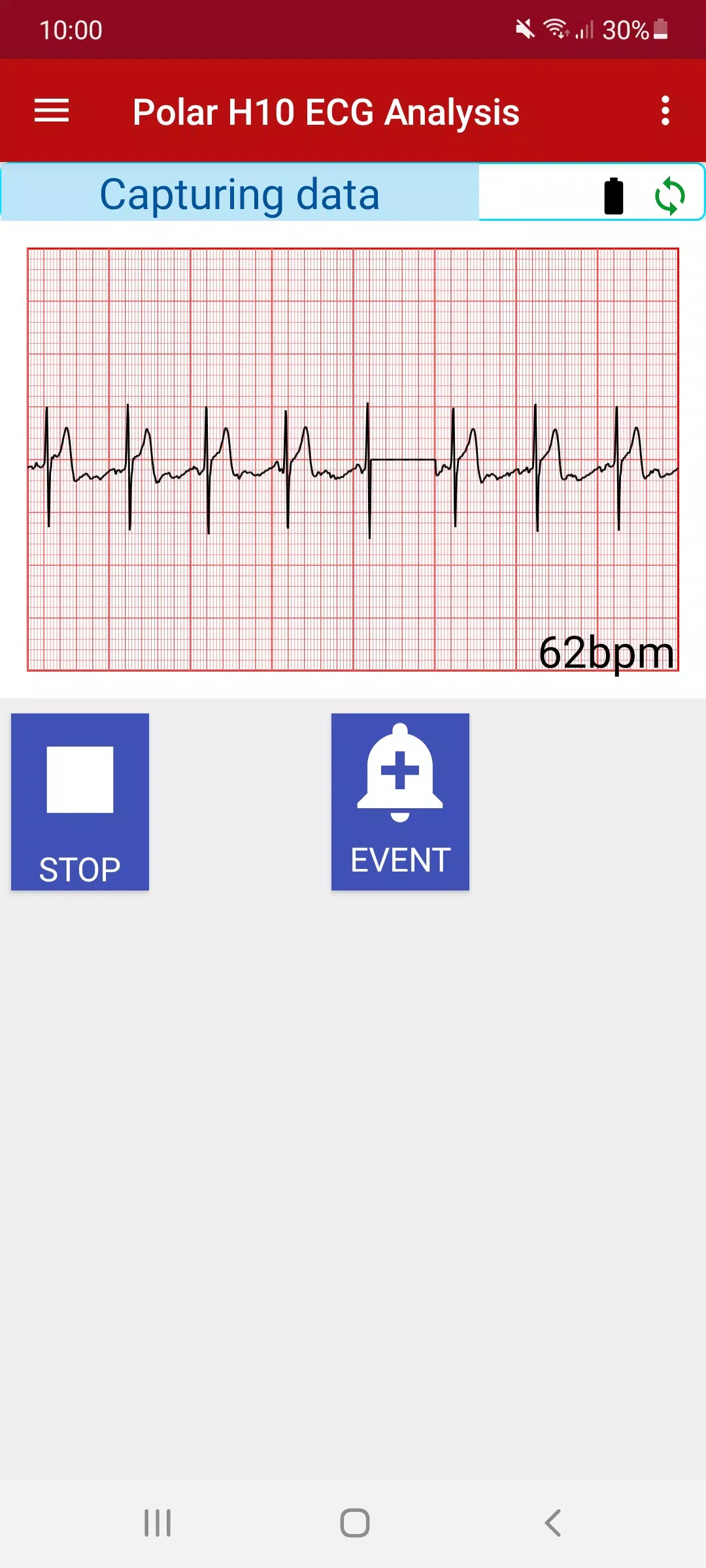 Polar H10 ECG analysis APK for Android Download