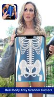 Real Body Xray Scanner Camera تصوير الشاشة 2