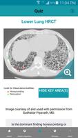 Rad Rounds - UIP to IPF 스크린샷 2