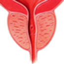 APK Prostate Cancer Calculator
