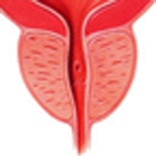 Prostate Cancer Calculator