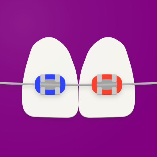 Attacchi Ortodontici BraceMate