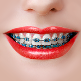 Braces Camera 图标