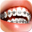 Braces Camera Photo Editor APK