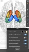 1 Schermata Brain Tutor 3D