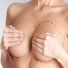 Breast Anatomy biểu tượng