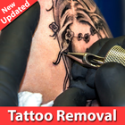 Tattoo Removal At Home icône
