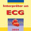 Interpreter un ECG