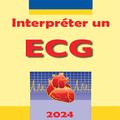 Interpreter un ECG