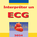 Interpreter un ECG APK