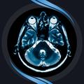 CT Scan Brain