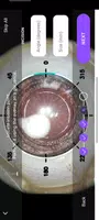 4 Schermata MicroART