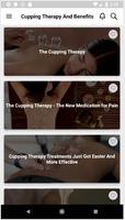 Cupping Therapy And Benefits bài đăng